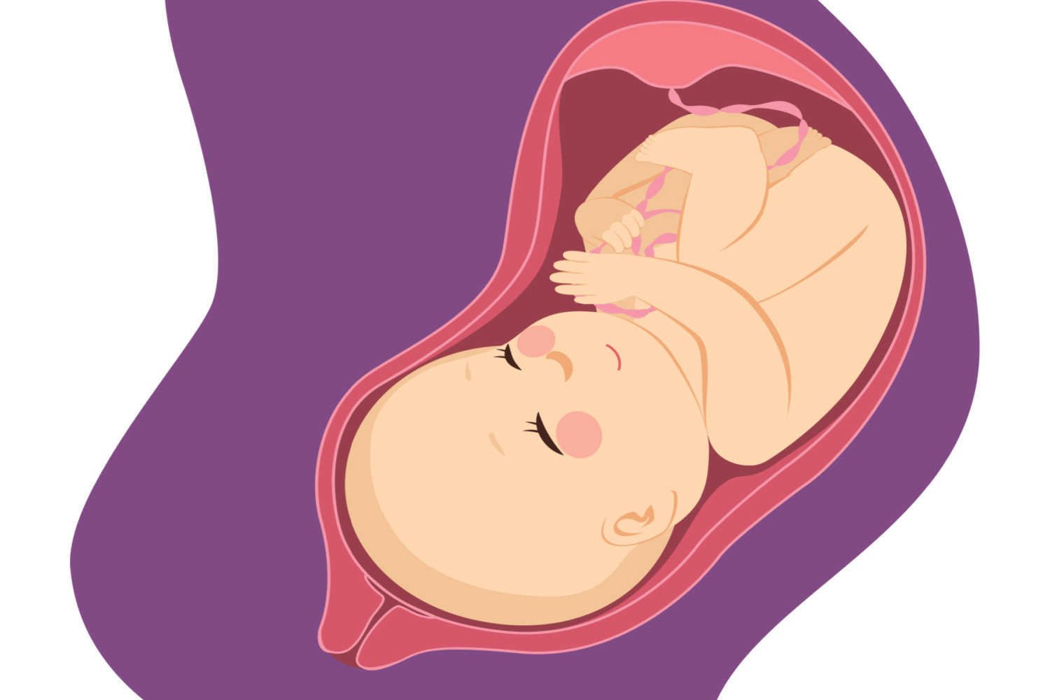 Impact of High Blood Pressure on Babies