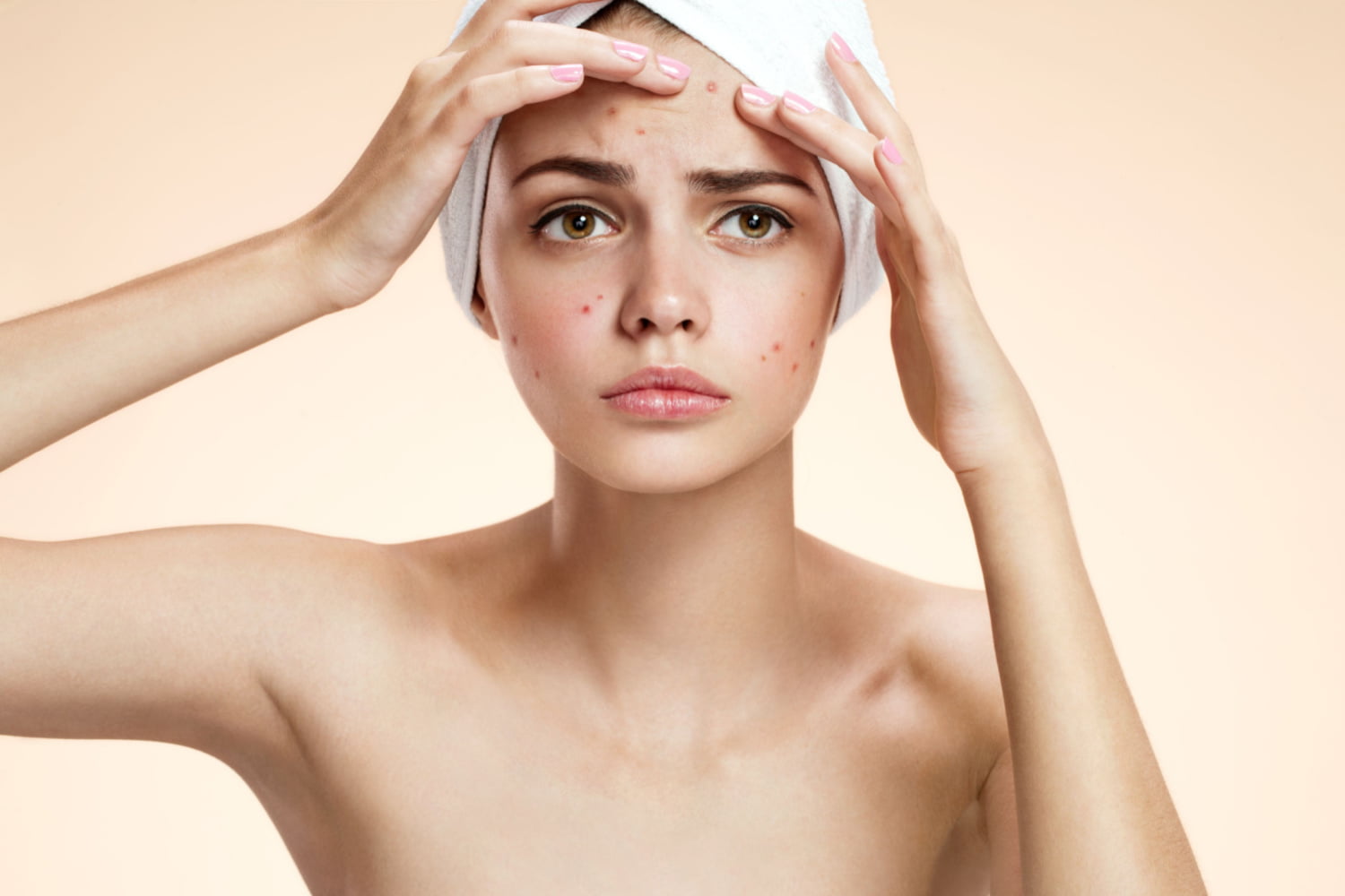 How to Choose Acne Treatment Products During Pregnancy?