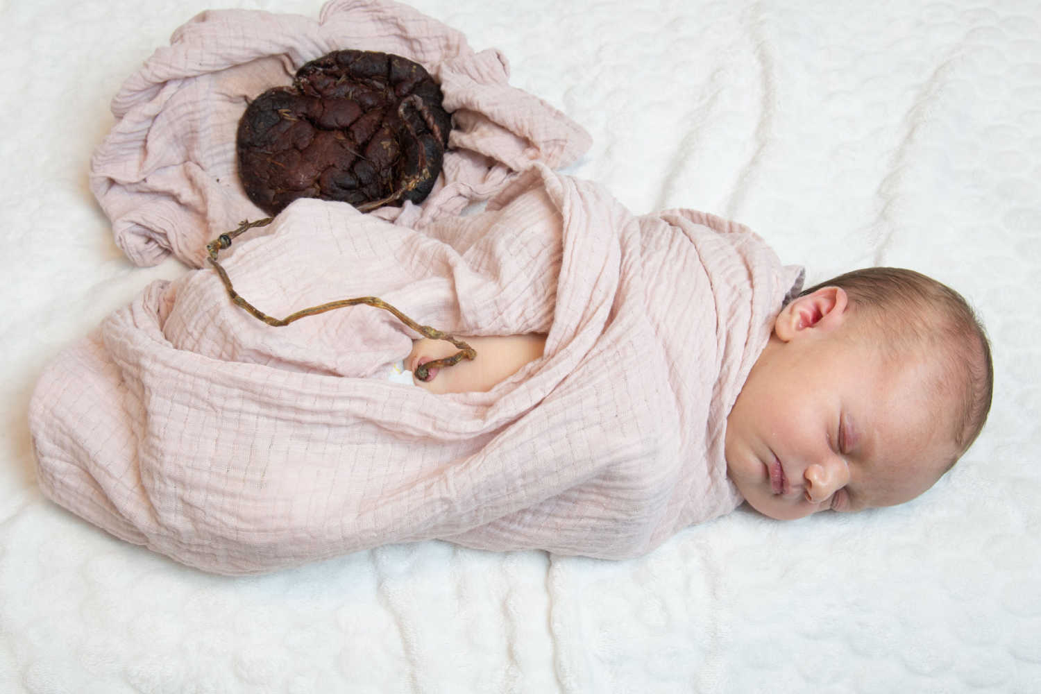 lotus birth baby with placenta