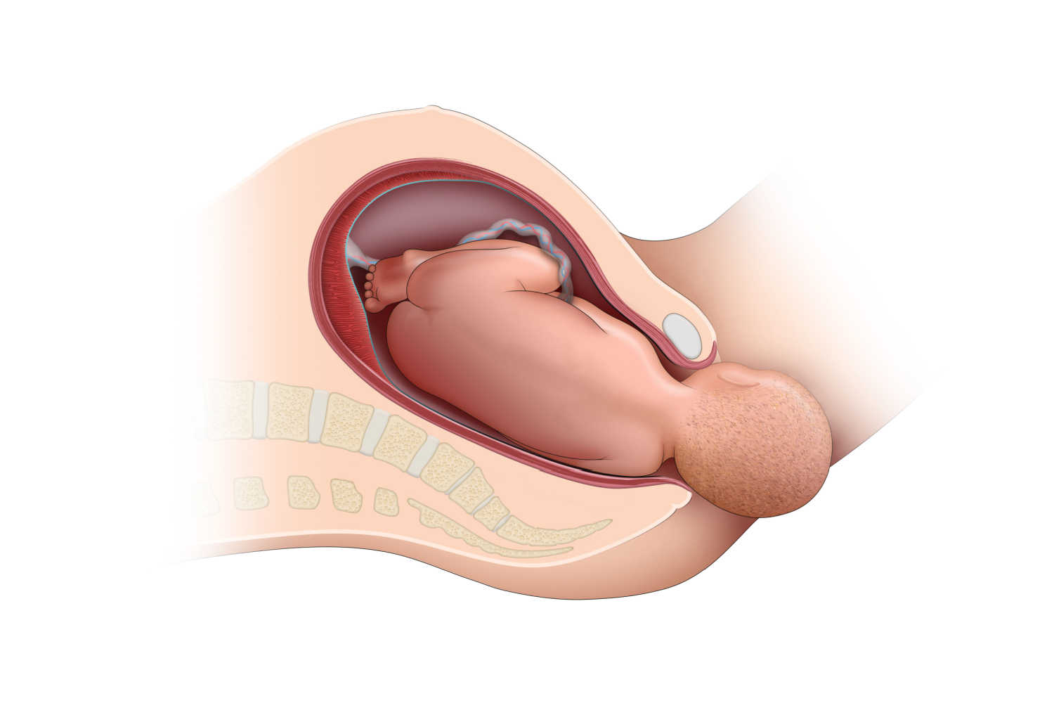 Vaginal birth - Types Of Delivery Methods