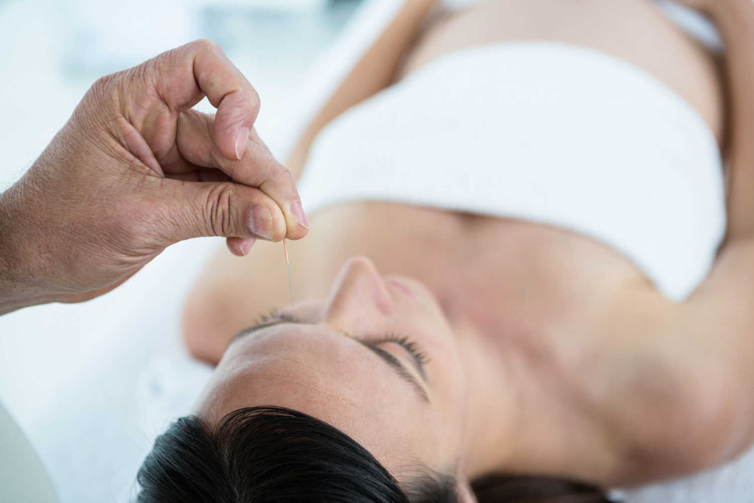 woman getting acupuncture during pregnancy