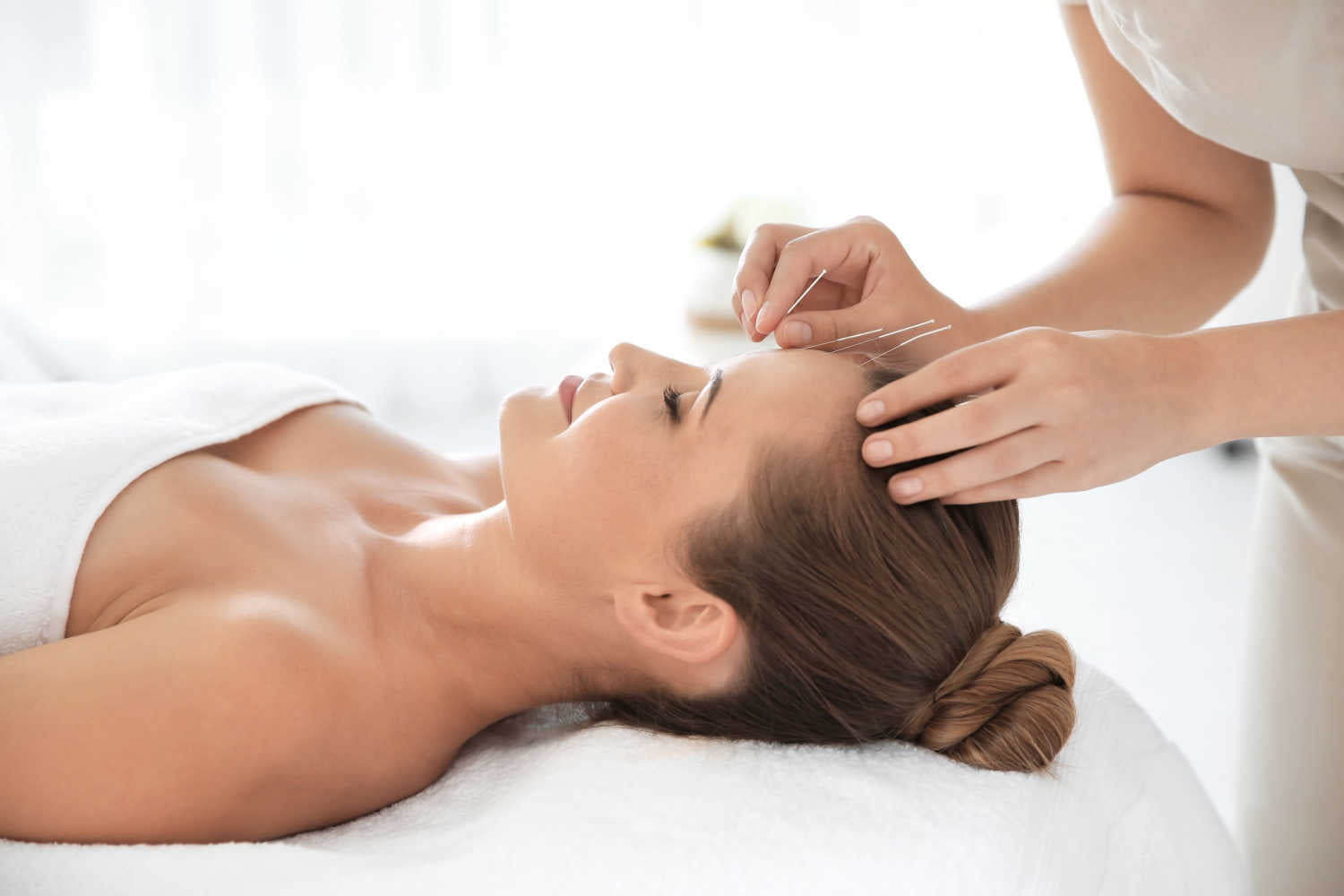therapist doing acupuncture