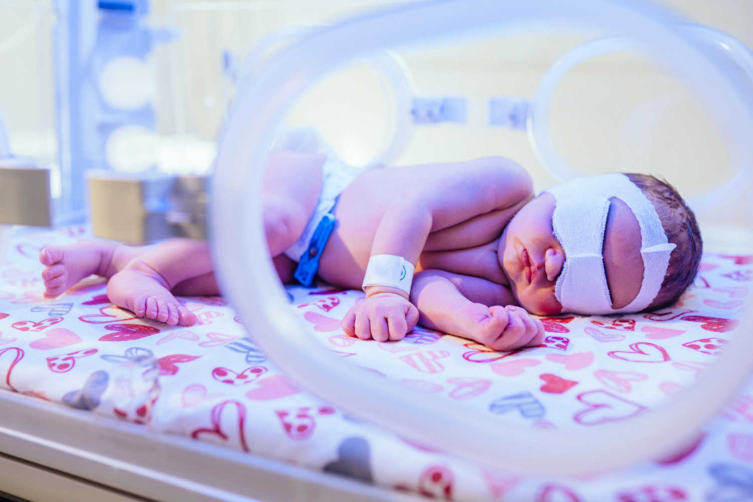 Benefits of Providing DSC For NICU Babies