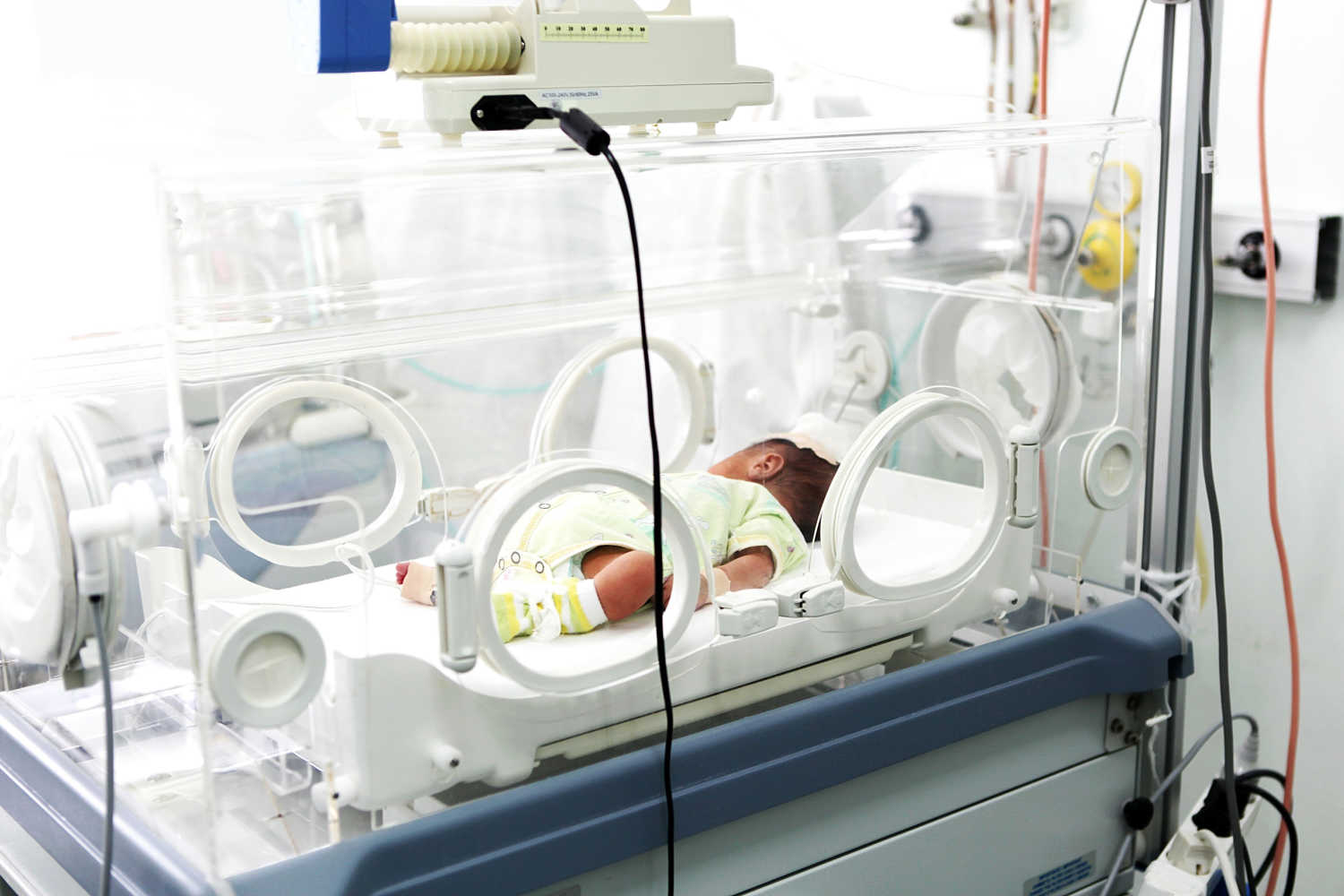 Developmental Supportive Care For Newborns in NICU