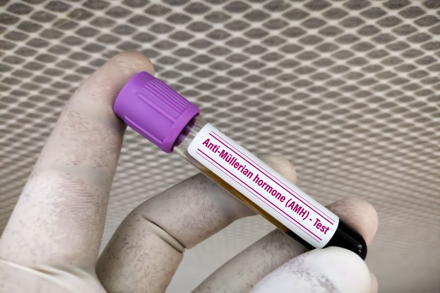 AMH test for testing egg reserve