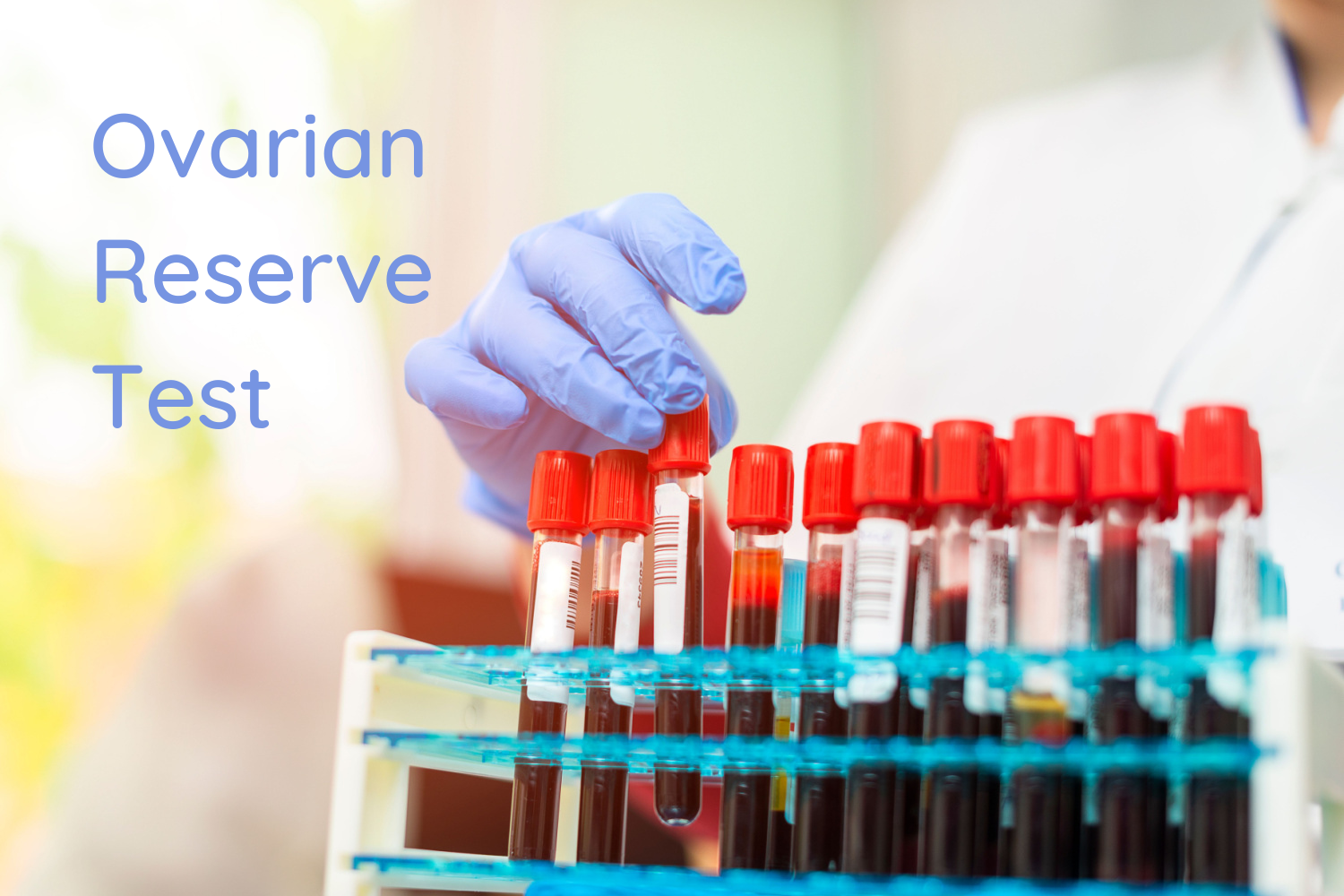 Ovarian Reserve Test For Infertility – How it Helps Measure Your Fertility Levels