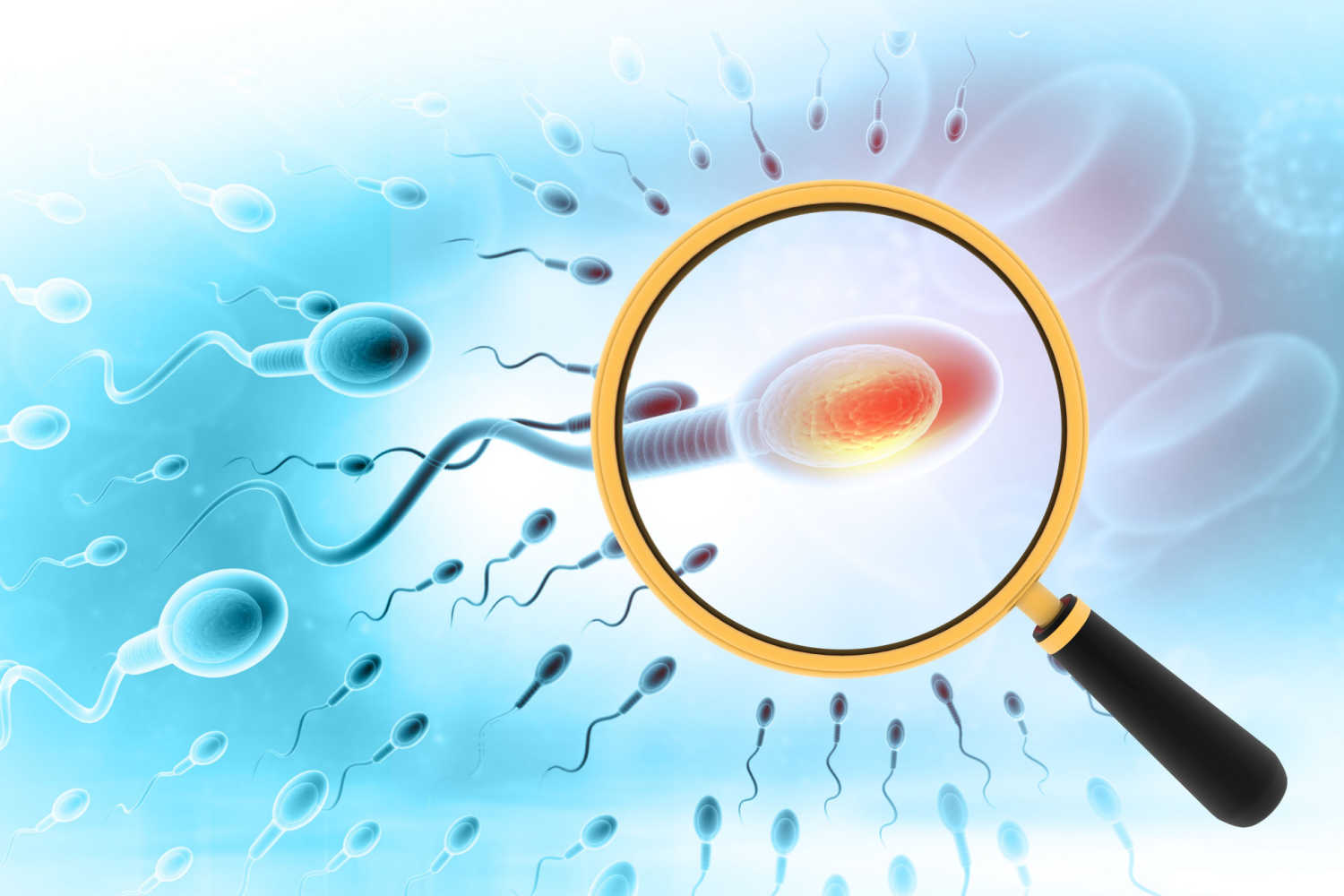 Sperm Analysis