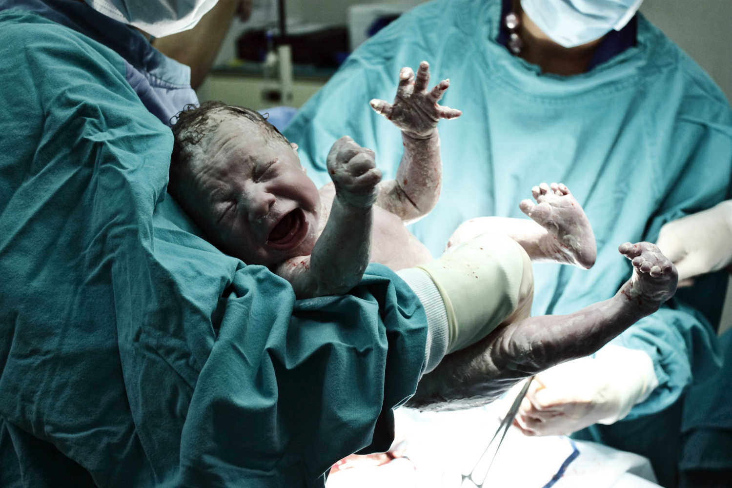 newborn baby and doctors