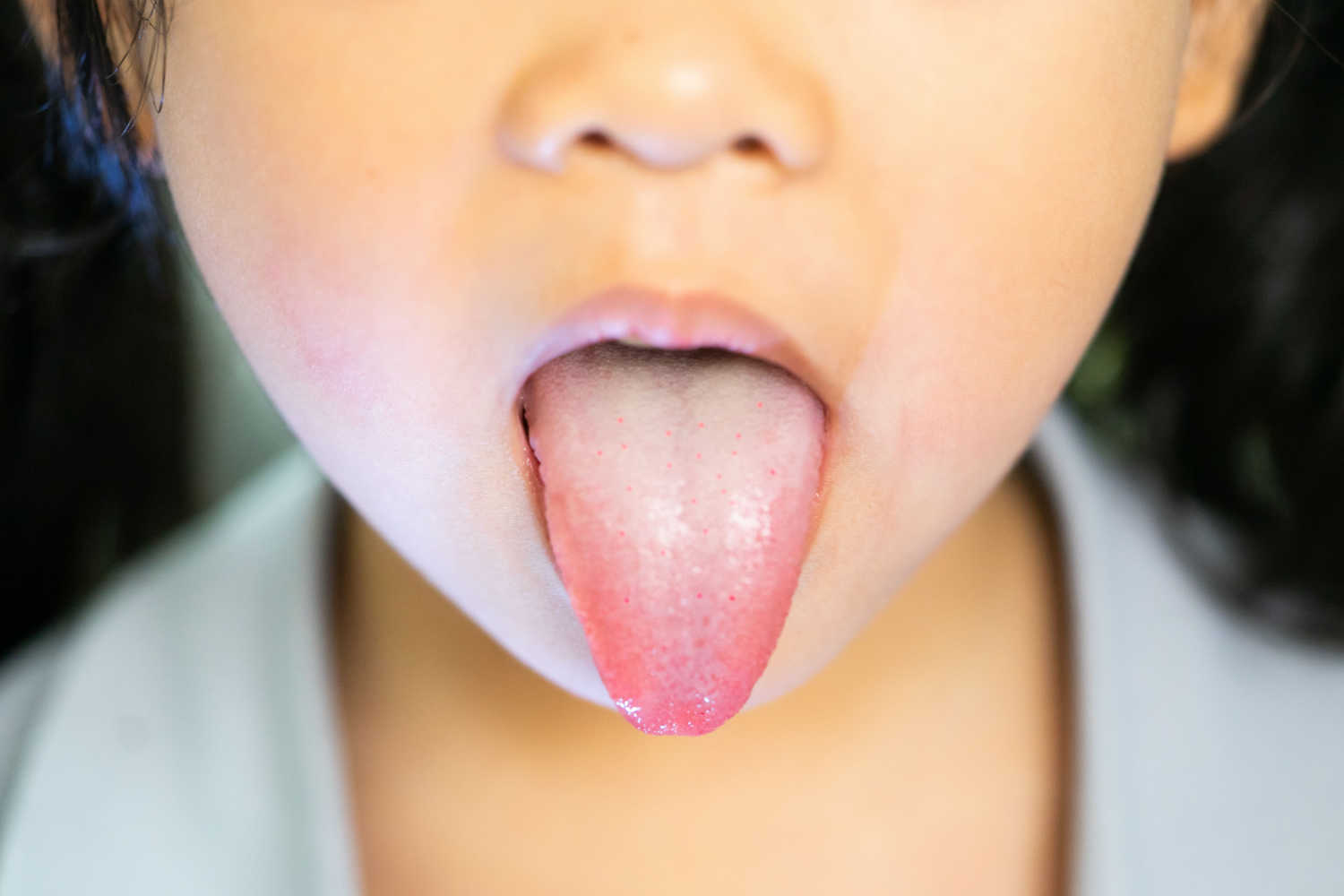 Bad oral hygiene causes bad breath in toddlers
