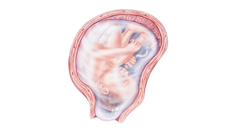 En Caul birth