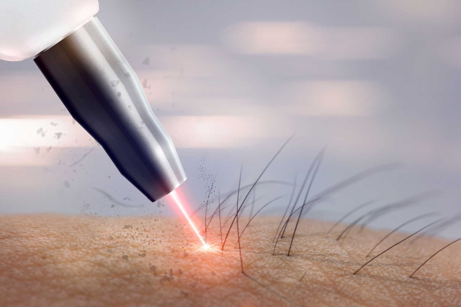 How Does Laser Hair Removal Work_