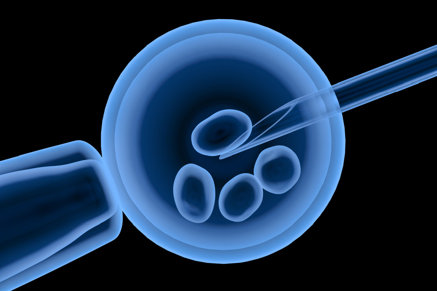 Alcohol And IVF Treatment