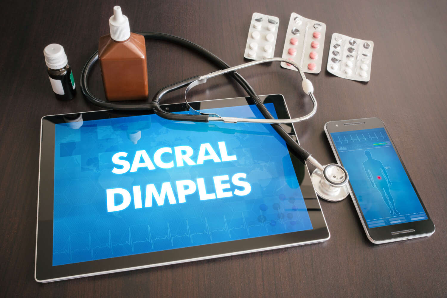 Sacral Dimples in Newborns What is it, Types and Complications Being The Parent