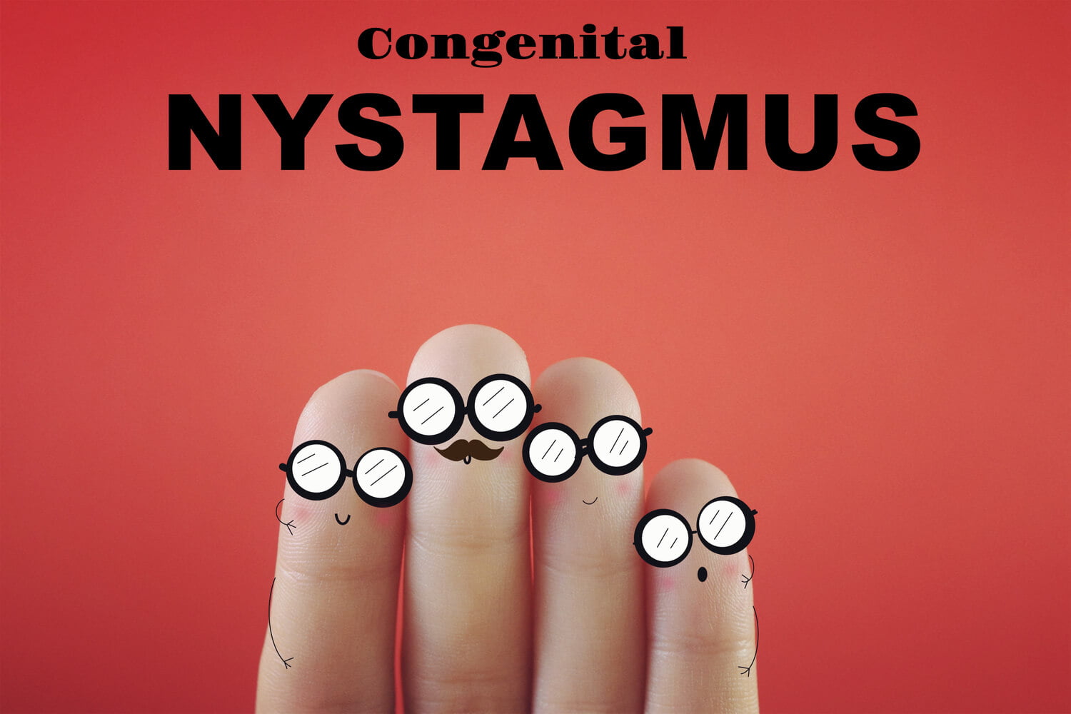 Congenital Nystagmus in Babies Causes, Symptoms And Treatment Being