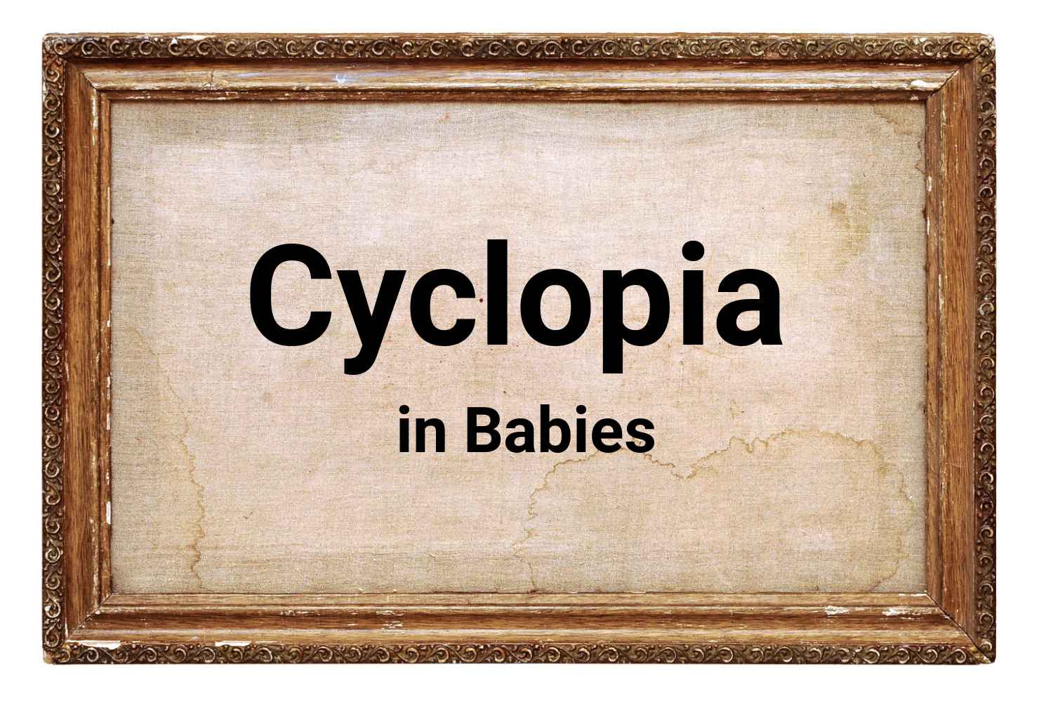 Cyclopia in Babies