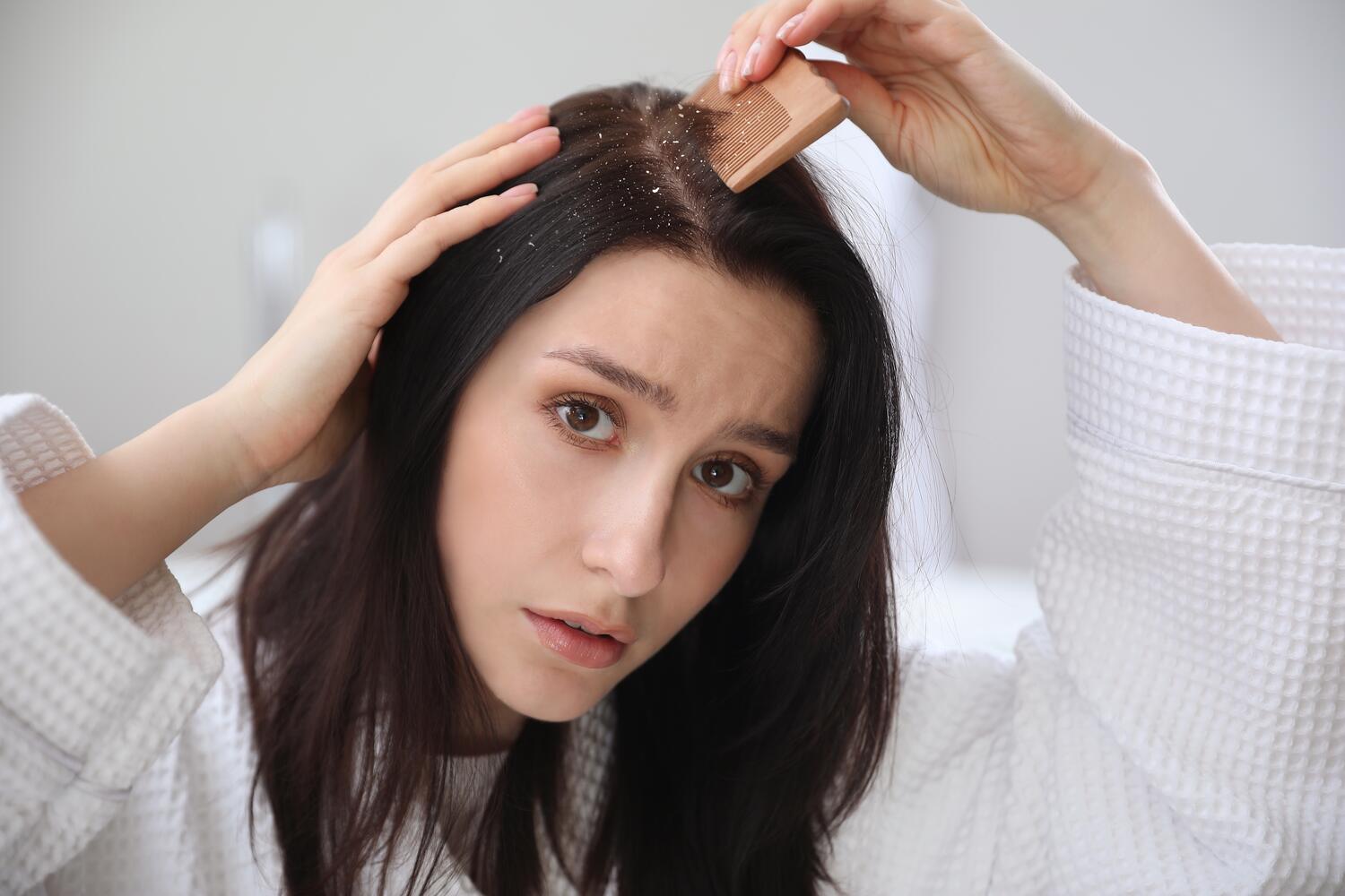 woman hair dandruff