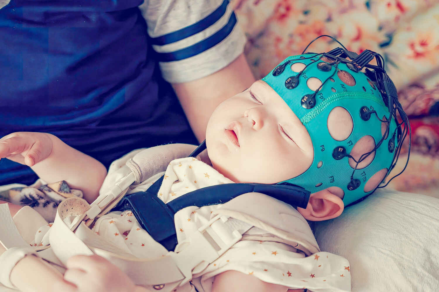 Baby undergoing EEG