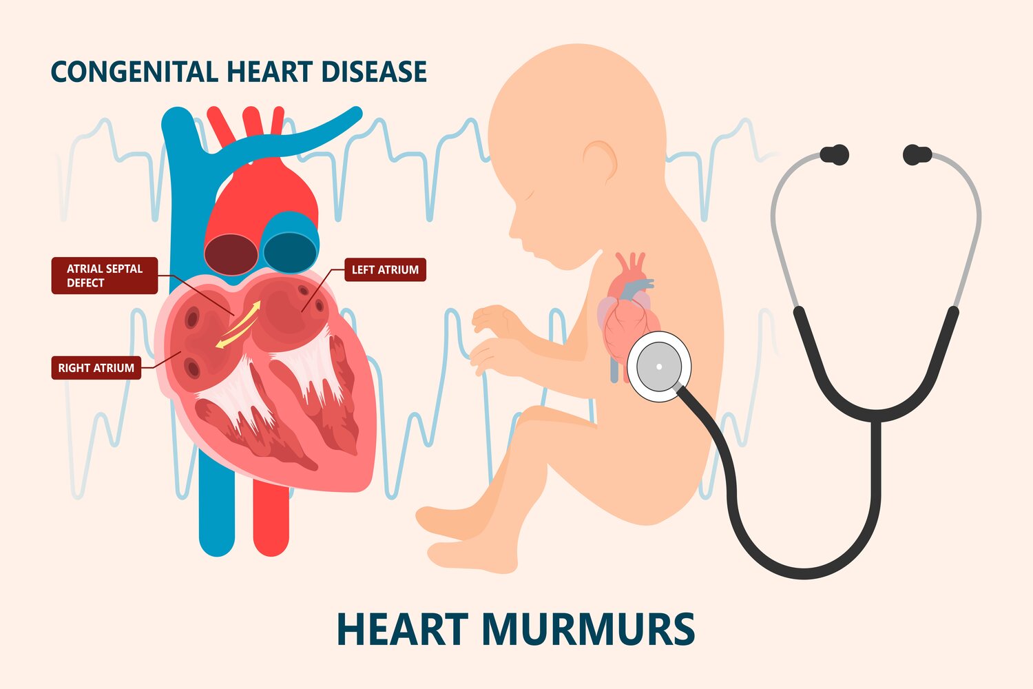 Heart murmur can be sign of an underlying condition