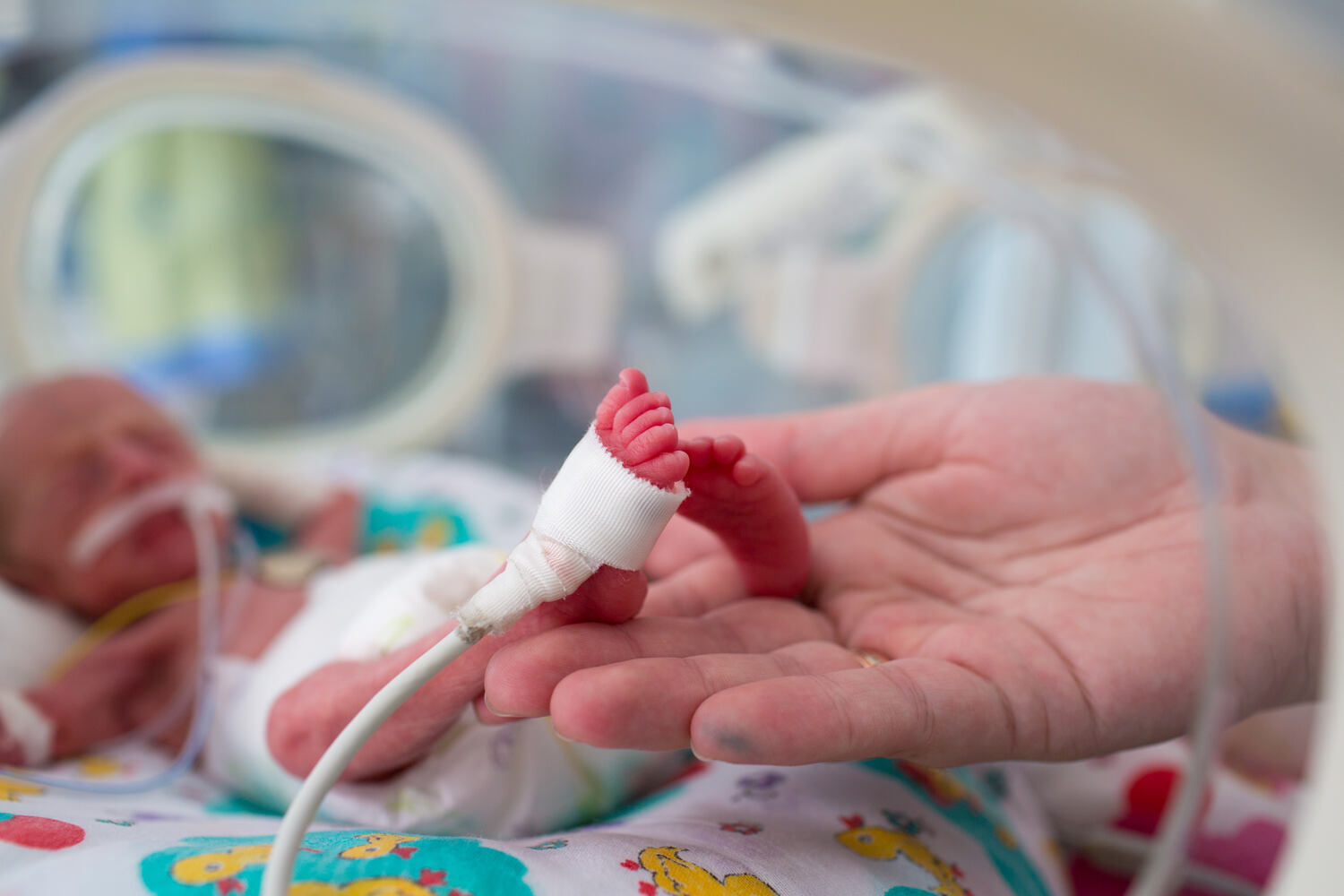 Premature birth can cause hearing loss