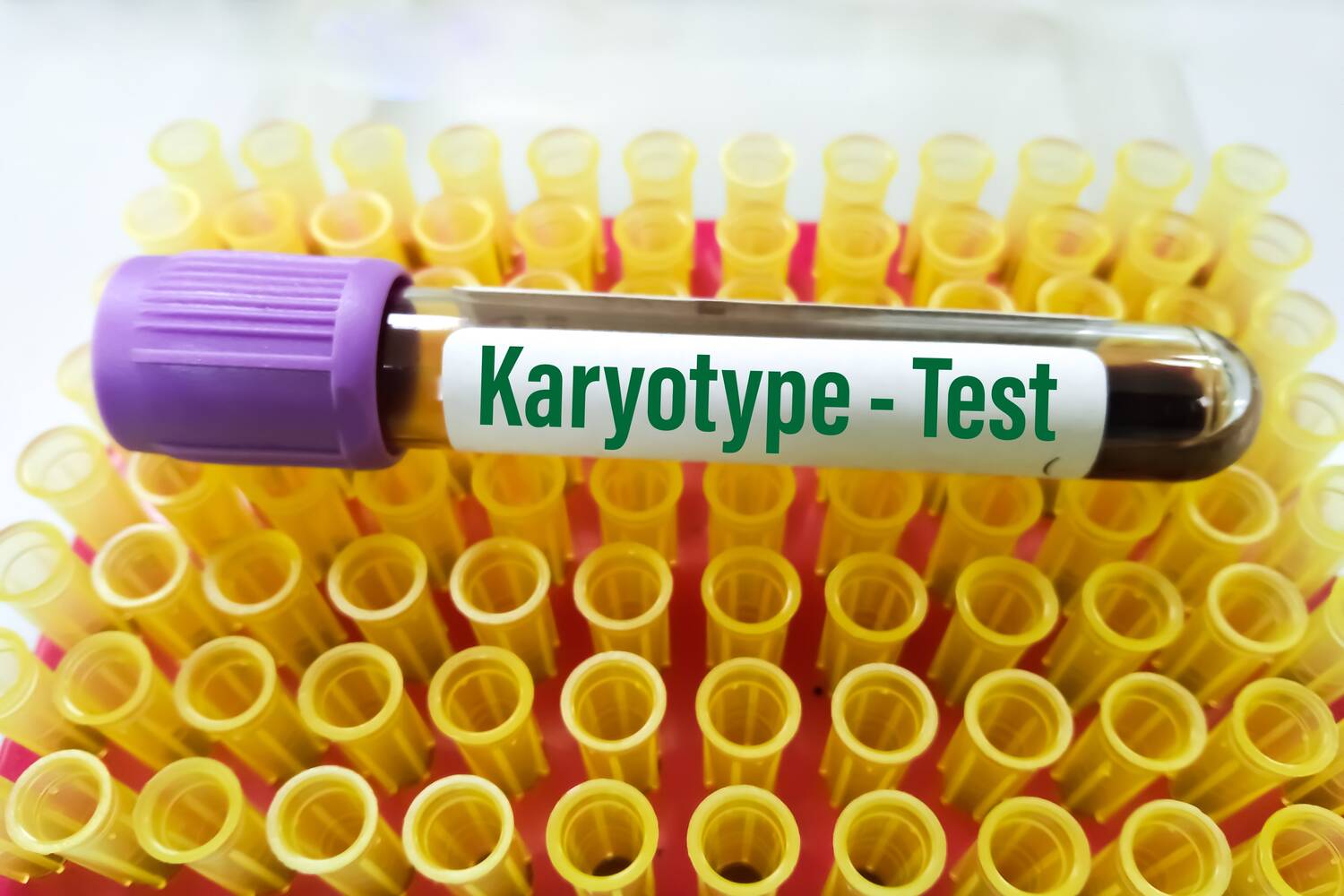 Karyotype testing