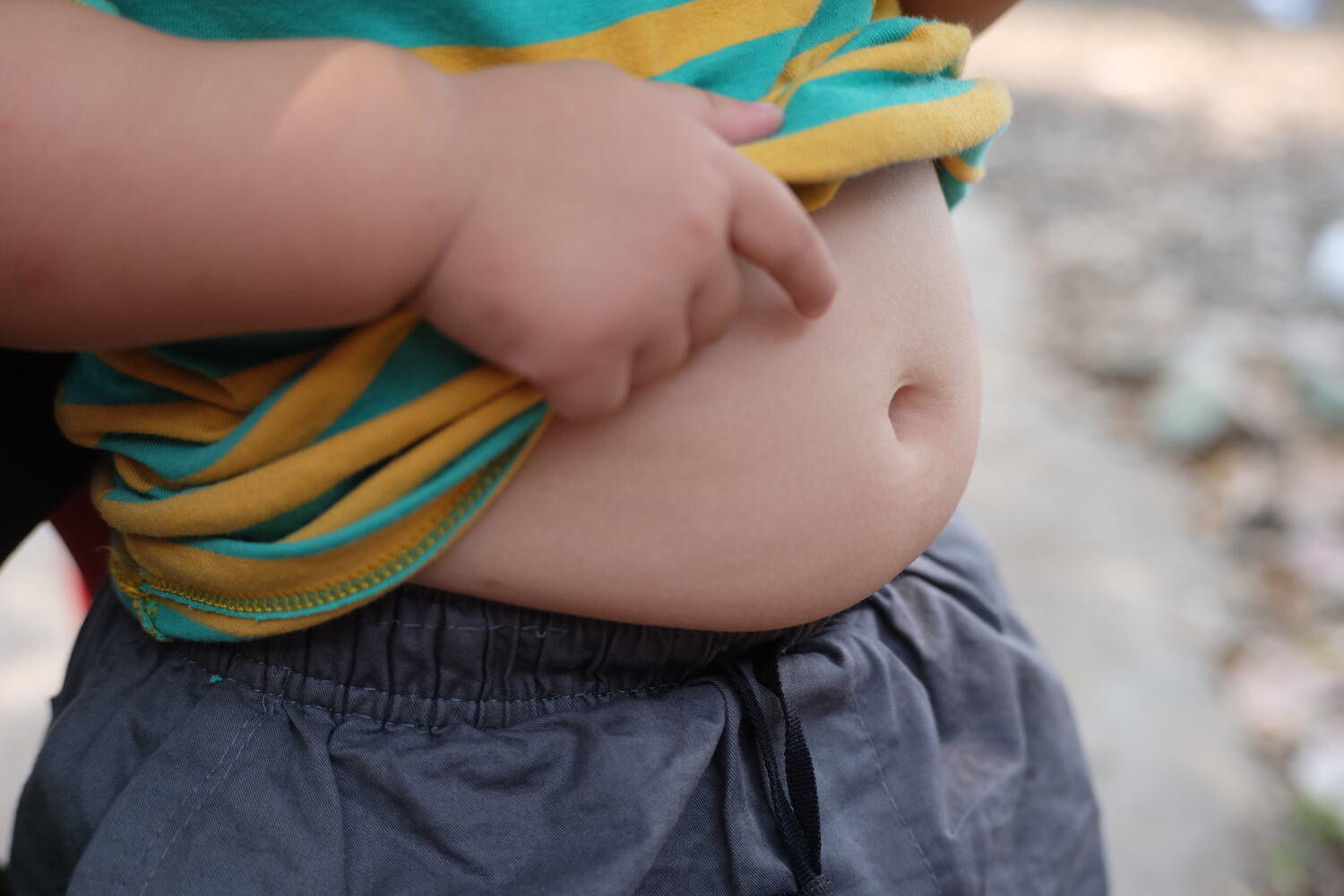An overweight toddler