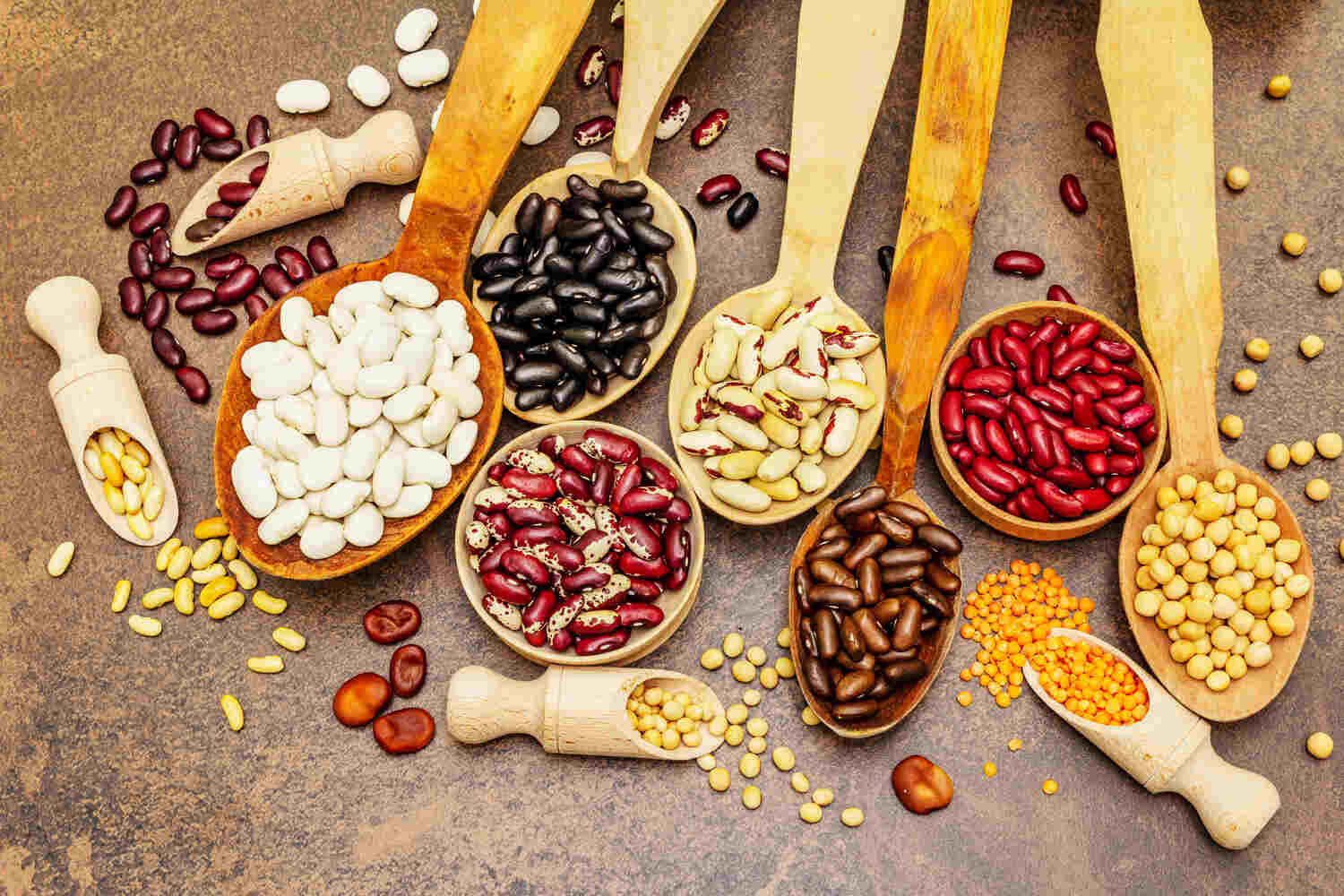 Beans and lentils help prevent kidney stones