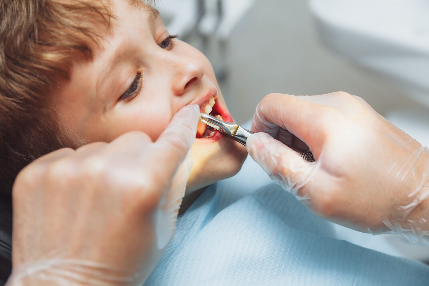 Dentist extracting tooth of a child