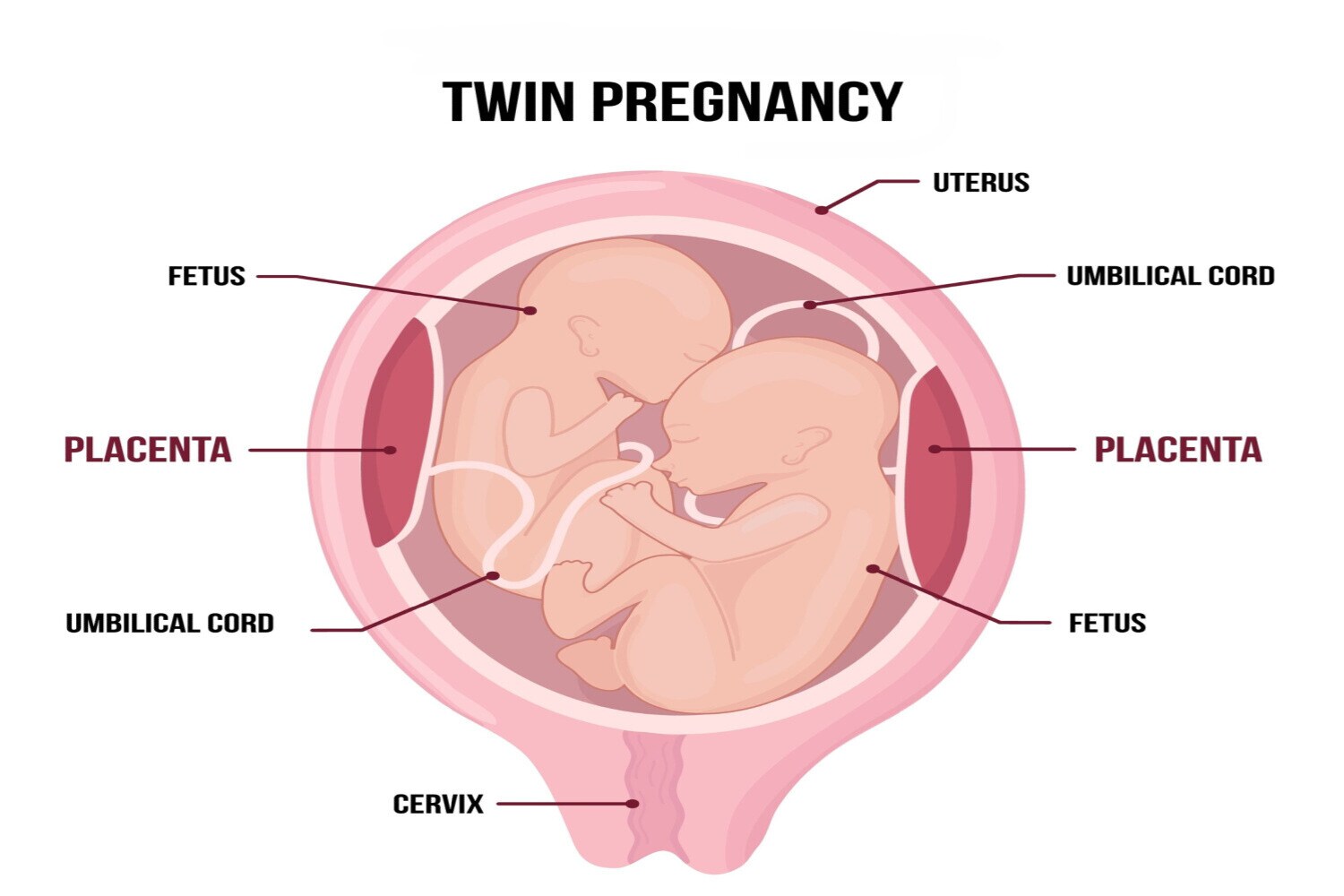 Causes Of An Umbilical Cord Prolapse
