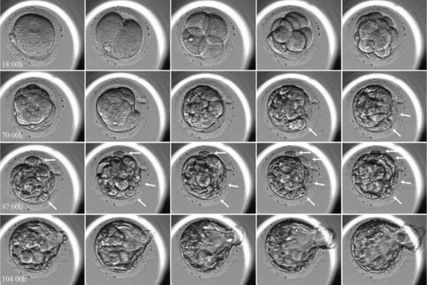 Embryoscope time lapse