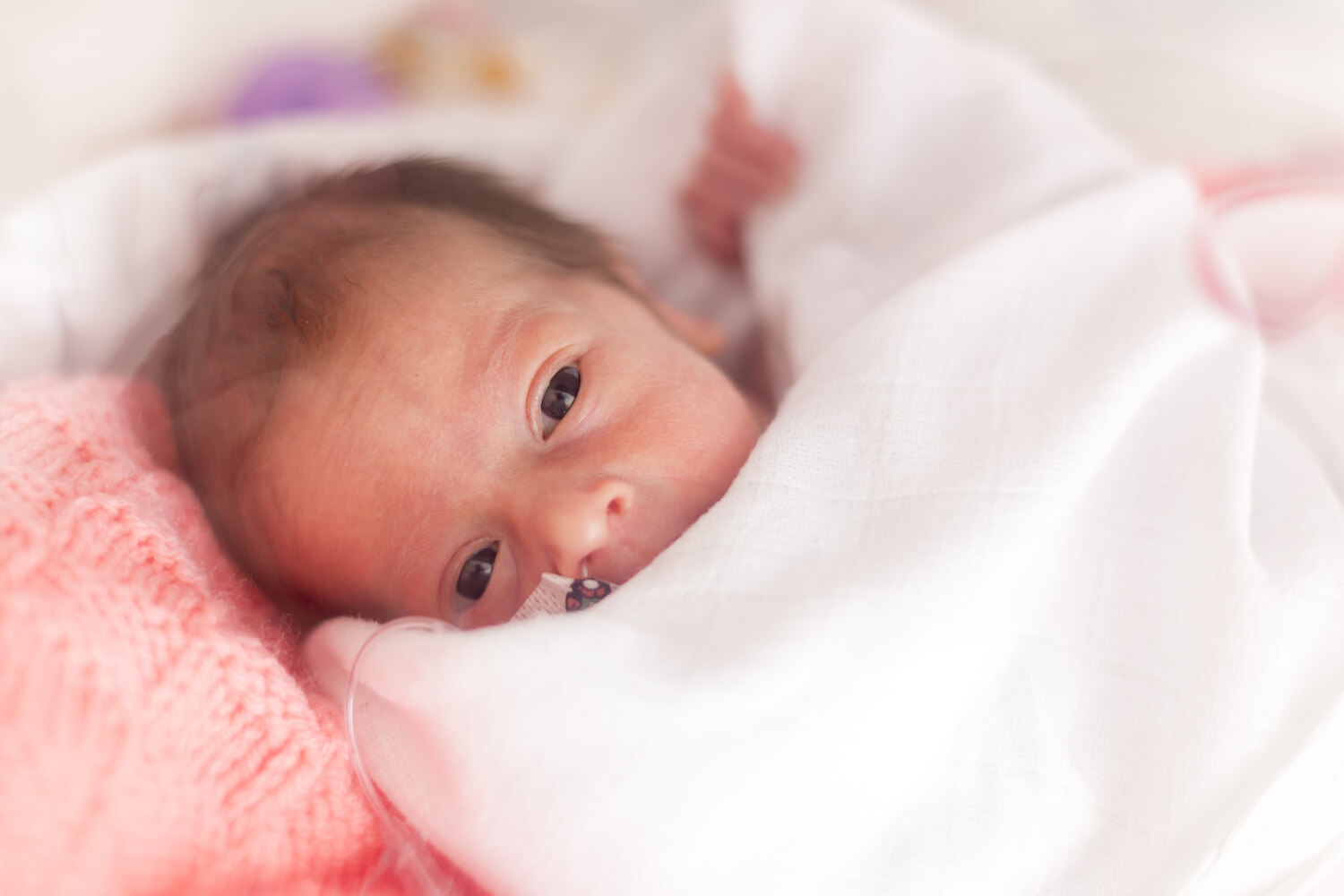 Bilirubin in premature babies