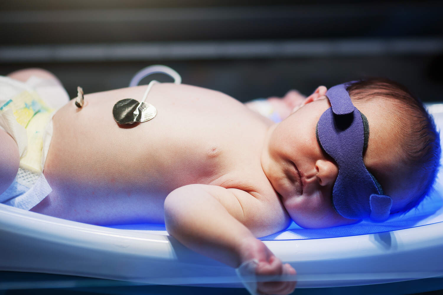 Phototherapy for jaundice