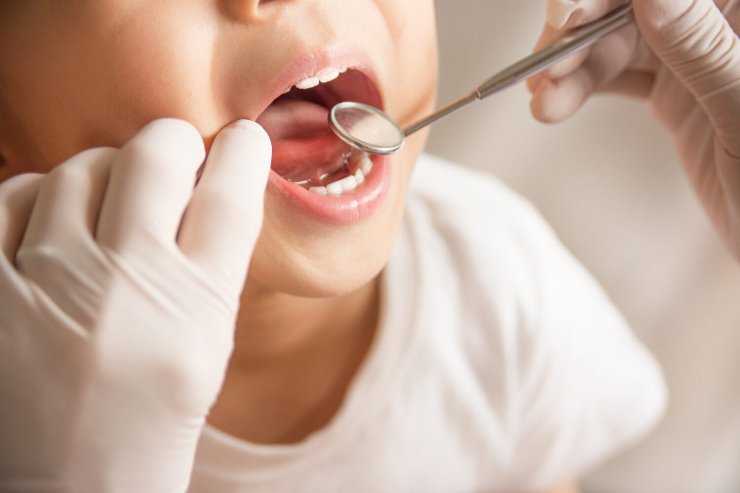 A dentist examining a child's teeth