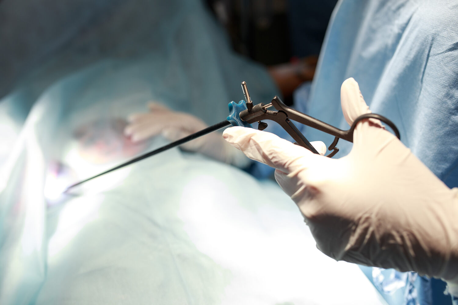 laparoscopy for uterine abnormality