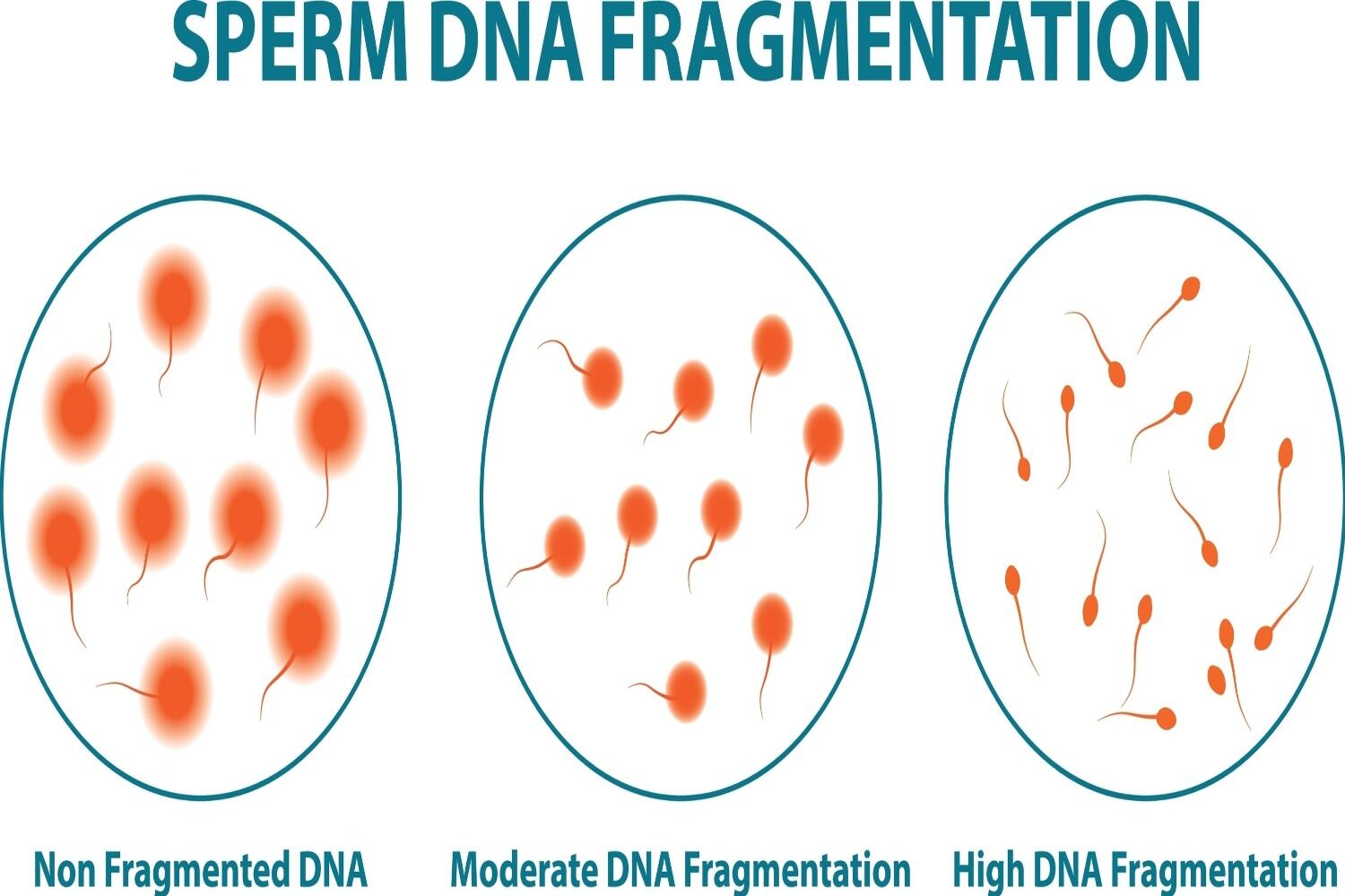Measuring sperm DNA fragmentation