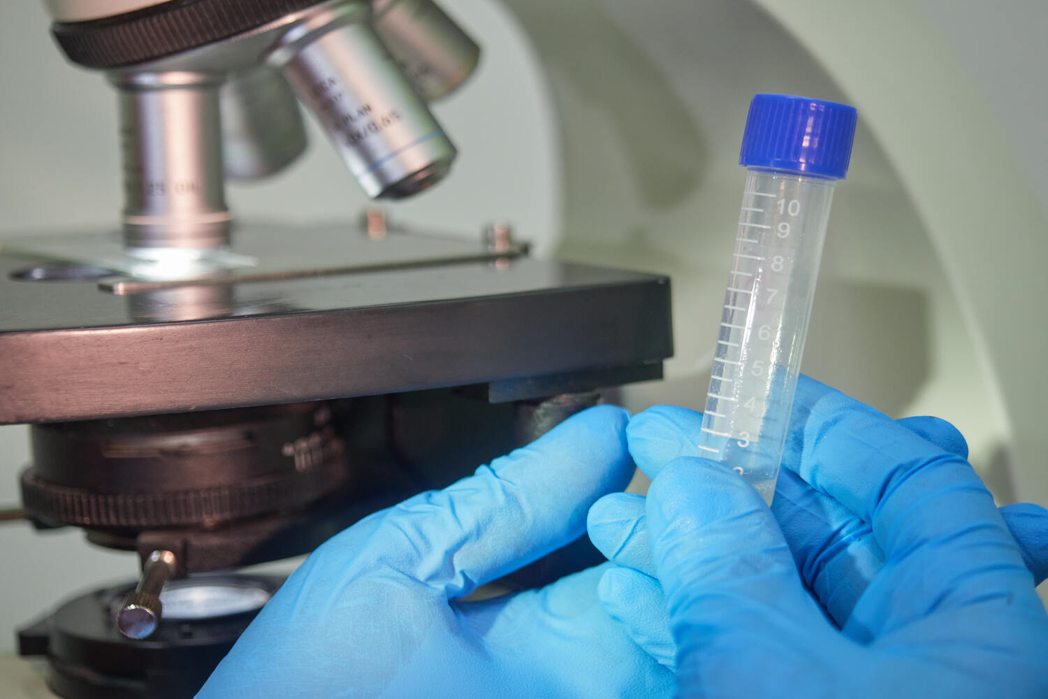 Male Sperm DNA Fragmentation Test – A Complete Guide