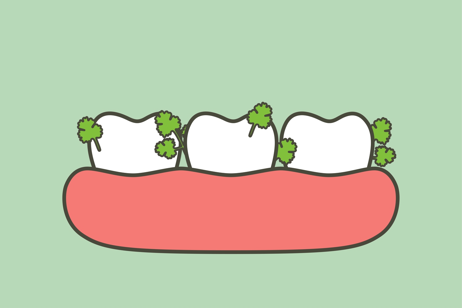 Object stuck in teeth