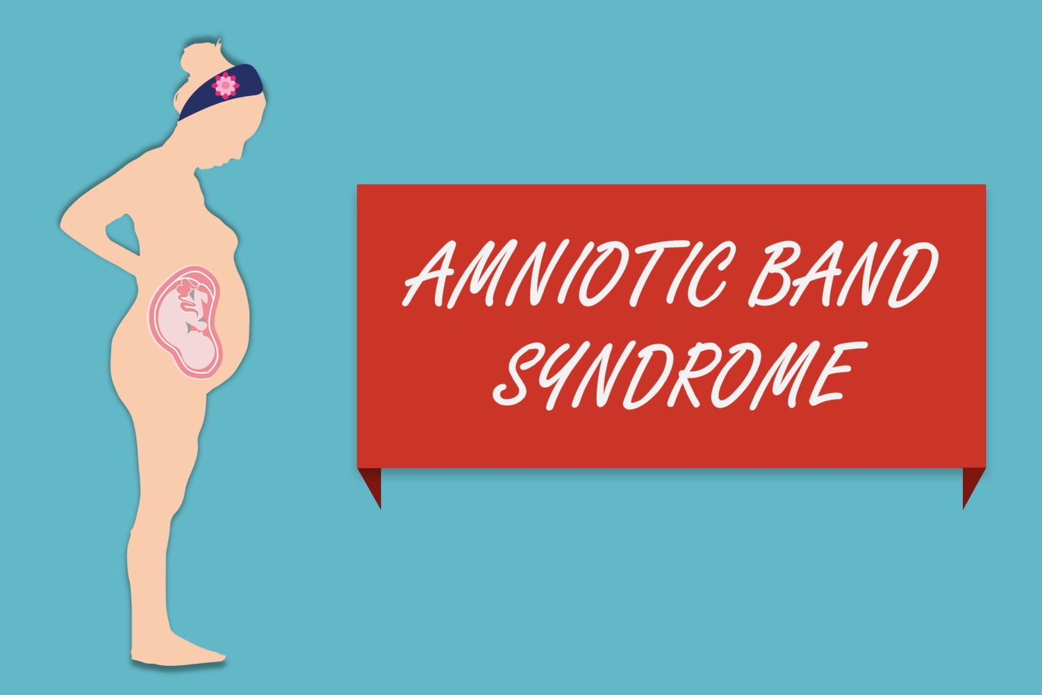 What Is Amniotic Band Syndrome and What Are Its Causes_