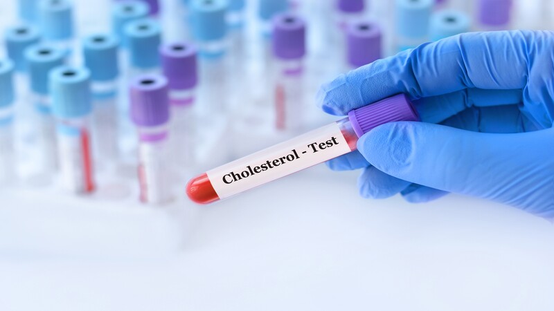 How to detect high cholesterol
