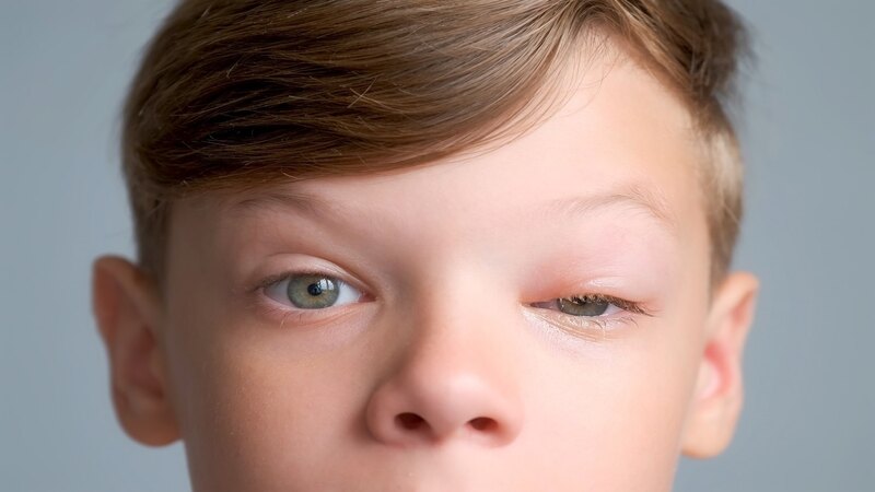 Signs and Symptoms of Rhabdomyosarcoma